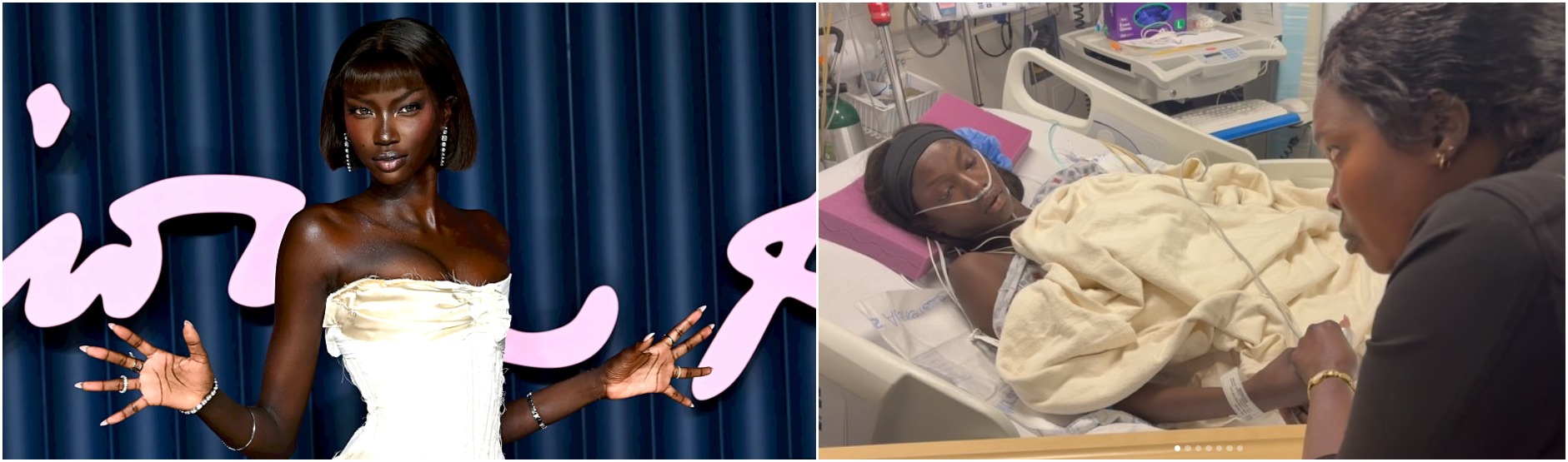 Anok Yai recovering in hospital after lung surgery