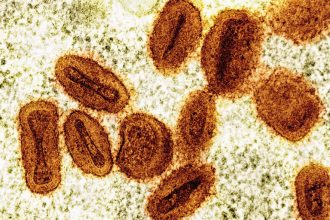 Microscopic view of oval-shaped virus particles